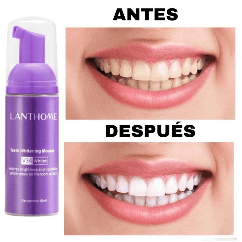 BLANQUEAMIENTO DENTAL LANTHOME FRESH WHITE [RESULTADO PROBADO]