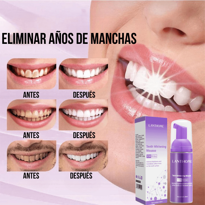 BLANQUEAMIENTO DENTAL LANTHOME FRESH WHITE [RESULTADO PROBADO]